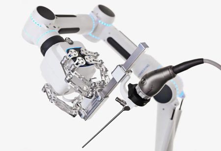 Advancing Precision in Flexible Endoscopic Surgery Advancing Precision in Flexible Endoscopic Surgery
